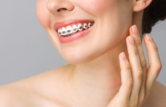 How Orthodontic Care Enhances Confidence And Everyday Smiles