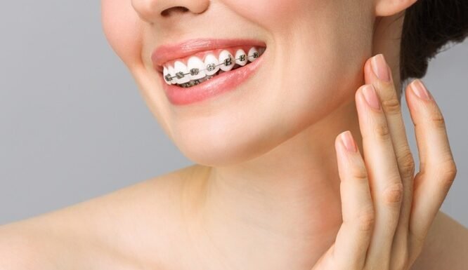 How Orthodontic Care Enhances Confidence And Everyday Smiles