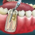 6 Diagnostic Tools Used To Enhance General Dental Exams