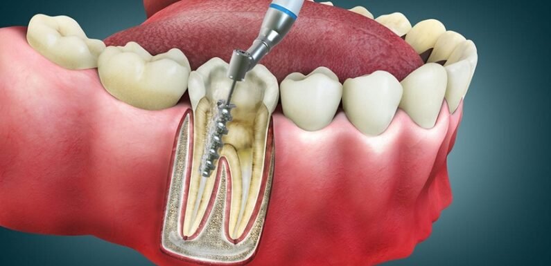 6 Diagnostic Tools Used To Enhance General Dental Exams